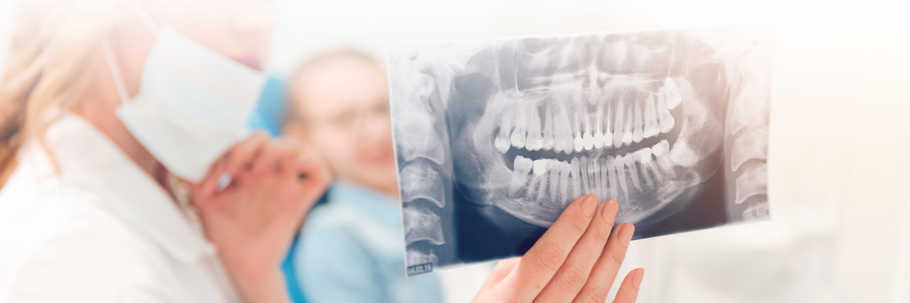 Wisdom Teeth Extraction Dental Procedures Myrtle Beach Oral Surgeon